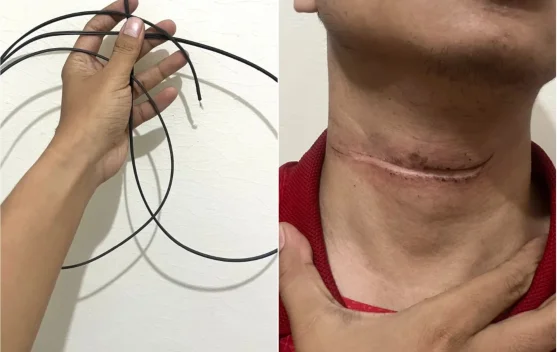 Alarm Keras dari Kabel Semrawut di Sragen: Jangan Tunggu Nyawa Melayang