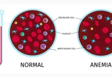 Jangan Sepelekan Anemia, Waspada Faktor Resiko Gangguan Jantung dan Ginjal