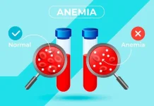 Alami Anemia, Makanan Ini Wajib Dikonsumsi
