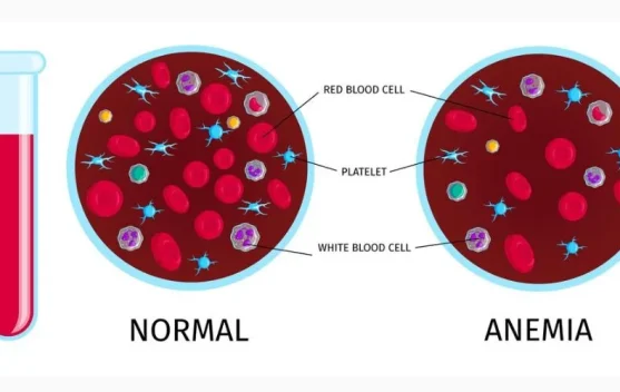 Jangan Sepelekan Anemia, Waspada Faktor Resiko Gangguan Jantung dan Ginjal