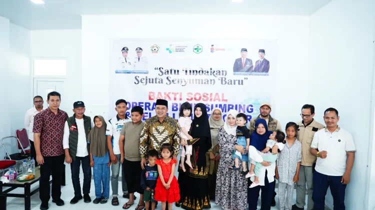 RSUD Datu Beru Rutin Gelar Bakti Sosial Operasi Bibir Sumbing