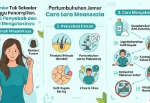 Ketombe Tak Sekadar Ganggu Penampilan, Kenali Penyebab dan Cara Mengatasinya