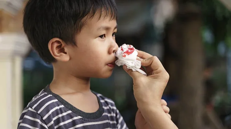 Orang Tua Jangan Panik Dulu ketika Anak Mimisan