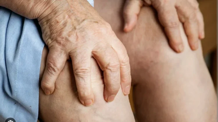 Kekurangan Protein Picu Berbagai Gangguan Kesehatan Serius