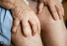 Kekurangan Protein Picu Berbagai Gangguan Kesehatan Serius