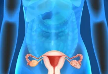 Kenali Endometriosis, Dapat Menyebabkan Nyeri Hebat dan Gangguan Kesuburan