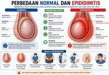 Kenali Gejala Epididimitis, Peradangan yang Menyebabkan Pembengkakan Testis