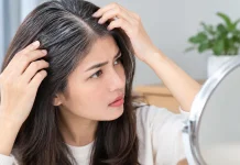 Uban di Usia Muda Tidak Selalu Tanda Penuaan Dini