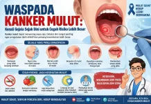 Waspada Kanker Mulut: Kenali Gejala sejak Dini untuk Cegah Risiko Lebih Besar