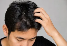 Kenapa Ketombe Gatal? Ini Penyebab dan Cara Mengatasinya