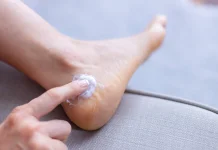 Kenali Penyebab Kaki Pecah-pecah dan Cara Mencegahnya