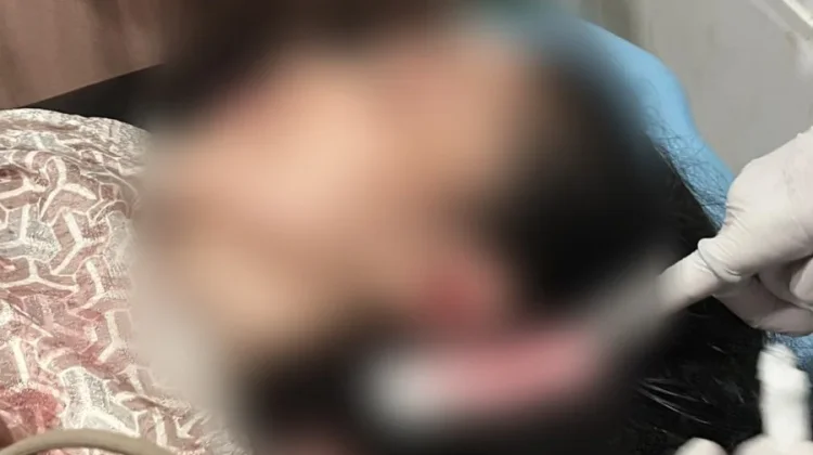 Dugaan Penganiayaan Istri hingga Kritis, Sat Brimob Polda Maluku Utara Disorot
