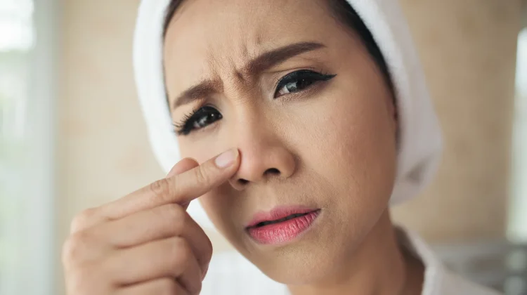 Mengenal Keratosis Pilaris dan Penyebabnya