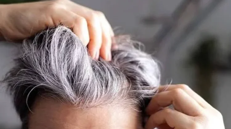 Rambut Mulai Beruban? Ini Cara Perawatannya agar Tetap Sehat