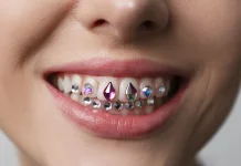 Tren Tooth Gem, Aksesoris Gigi Kekinian