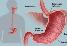 Menjaga Kesehatan Lambung saat Menjalankan Puasa