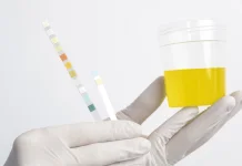 Benarkah Warna Urine Menentukan Kondisi Kesehatan Ginjal?