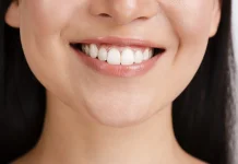 Tips Memutihkan Gigi dengan Bahan Alami