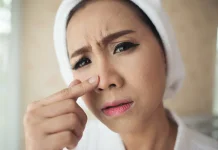 Mengenal Keratosis Pilaris dan Penyebabnya