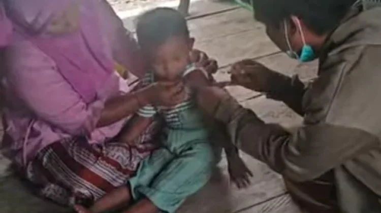 Kasus Suspek Campak di Buol Meningkat 2026, Imunisasi Rendah
