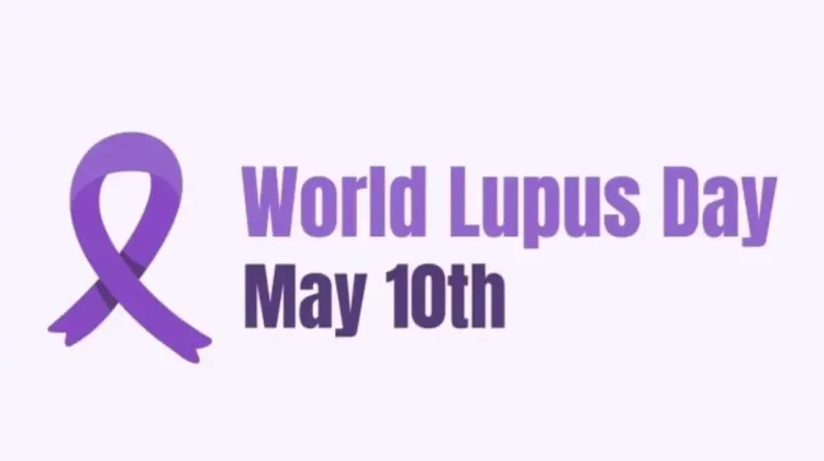 Hari Lupus Sedunia, Masyarakat Diajak Waspadai Gejala