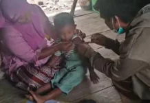 Kasus Suspek Campak di Buol Meningkat 2026, Imunisasi Rendah