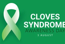 Mengenal Sindrom CLOVES, Edukasi Penyakit Langka sejak Dini