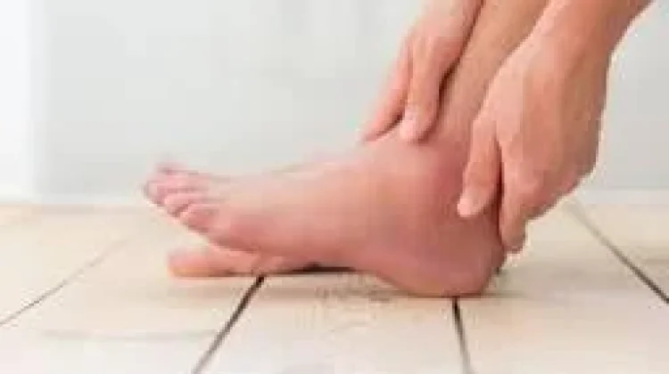 Minuman Manis Pemicu Asam Urat