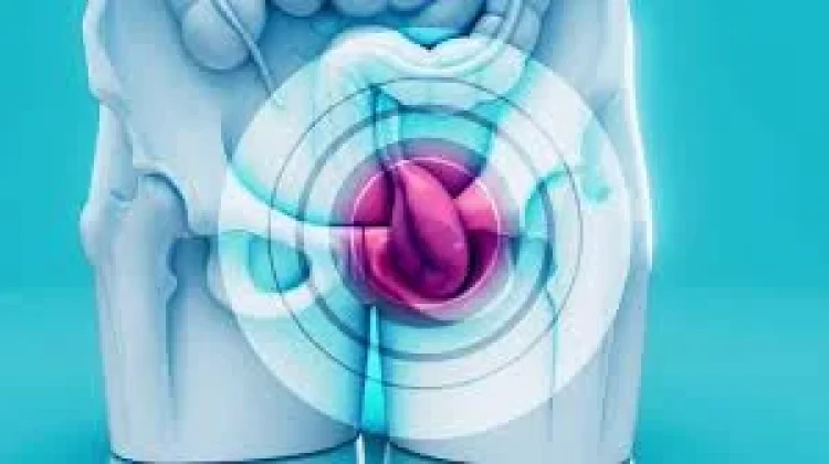Kenali Tanda dan Gejala Hernia pada Bayi