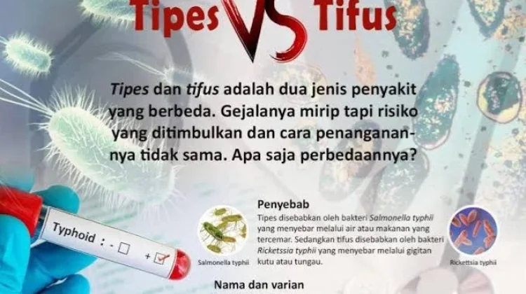 Kenali Gejala dan Perbedaan Penyakit Tipes