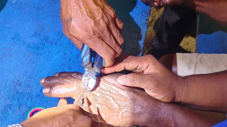 Aksi Kemanusiaan Damkar Malra, Berhasil Evakuasi Dua Cincin di Jari Warga 65 Tahun