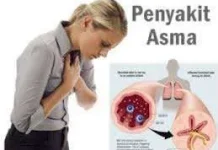 Asma, Penyakit yang Menyerang Saluran Pernapasan