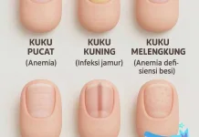 Waspada Perubahan Warna Kuku Bisa Jadi Masalah pada Kesehatan