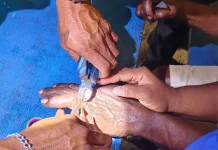 Aksi Kemanusiaan Damkar Malra, Berhasil Evakuasi Dua Cincin di Jari Warga 65 Tahun