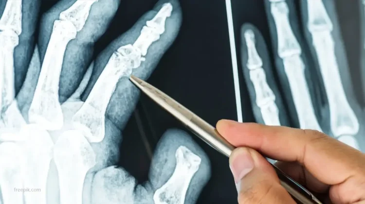 BRIN Develops Magnesium Alloy for Bone-Healing Biomedical Implants
