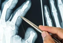 BRIN Develops Magnesium Alloy for Bone-Healing Biomedical Implants