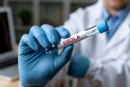 Kasus Ebola di Kongo Tembus 6.000, 2.911 Meninggal