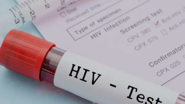 Dinkes Way Kanan Perkuat Layanan HIV/AIDS di Fasilitas Kesehatan