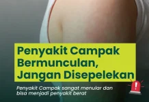Penyakit Campak Bermunculan Jangan Disepelekan
