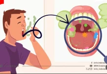 Begonia Multangula, Spesies Endemik Rentan yang Berpotensi Jadi Obat