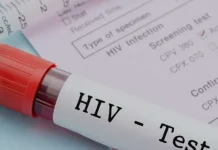 Dinkes Way Kanan Perkuat Layanan HIV/AIDS di Fasilitas Kesehatan
