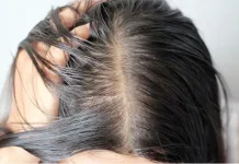 Rambut Lepek dan Berminyak, Kenali Penyebabnya sejak Dini