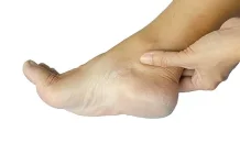 Tips Atasi Kaki Pecah-Pecah